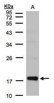 Anti-Cofilin 2 Antibody