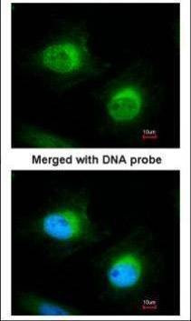 Anti-Cofilin 2 Antibody