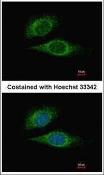 Anti-ESE1 (C-term) Antibody