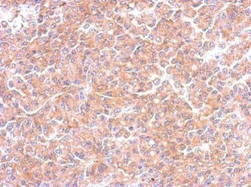 Anti-EML1 (C-term) Antibody