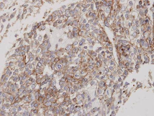 Anti-Flotillin 2 (C-term) Antibody