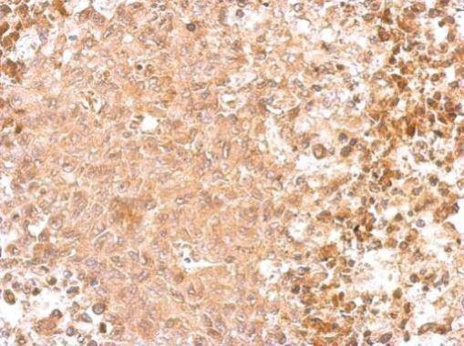 Anti-GAD65 (C-term) Antibody