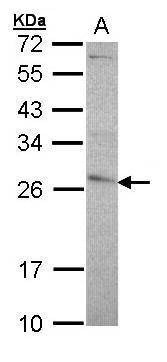 Anti-GSTP1 (N-term) Antibody