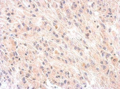 Anti-Factor H (internal) Antibody