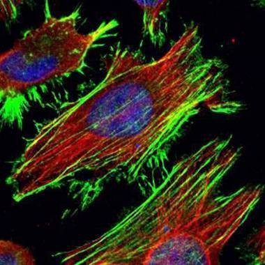 Anti-beta Actin Antibody