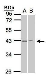 Anti-Galanin Receptor 2 (internal) Antibody