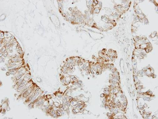 Anti-GPR164 (internal) Antibody