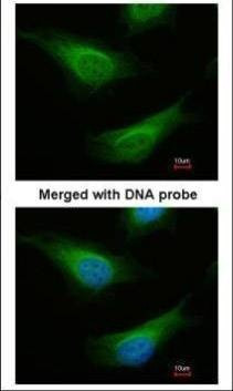 Anti-FANCC Antibody
