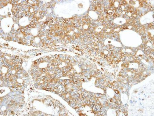 Anti-FANCC Antibody