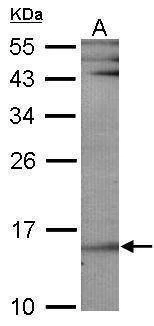 Anti-UBE2B Antibody