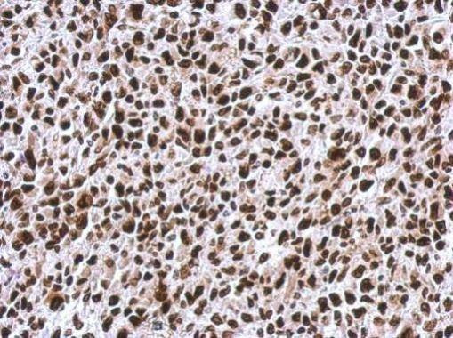 Anti-HMGA2 - ChIP grade Antibody