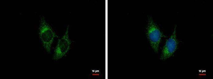 Anti-BNP Antibody