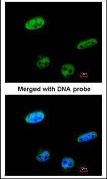 Anti-RASSF1 Antibody