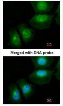 Anti-S100A11 Antibody