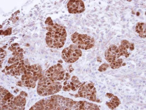 Anti-S100A11 Antibody