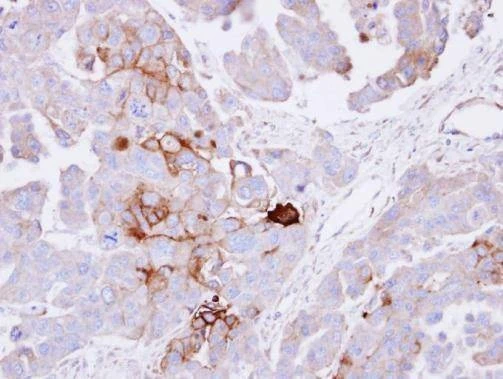 Anti-Alkaline Phosphatase (Tissue Non-Specific) Antibody