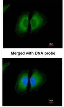 Anti-HMW Kininogen Antibody
