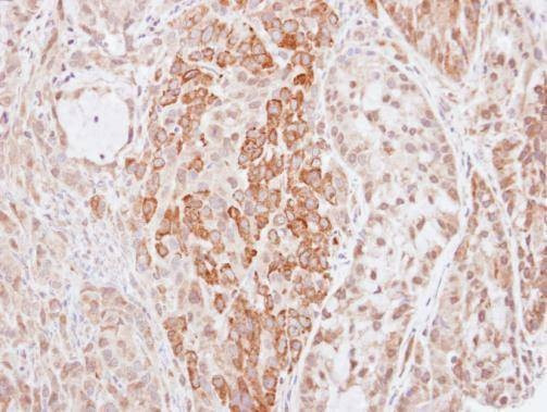 Anti-HMW Kininogen Antibody