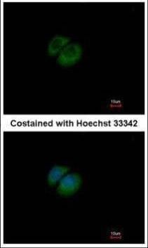 Anti-HPRT Antibody