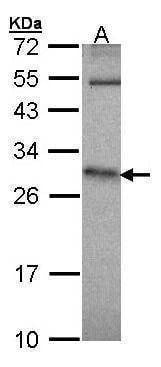 Anti-HPRT Antibody