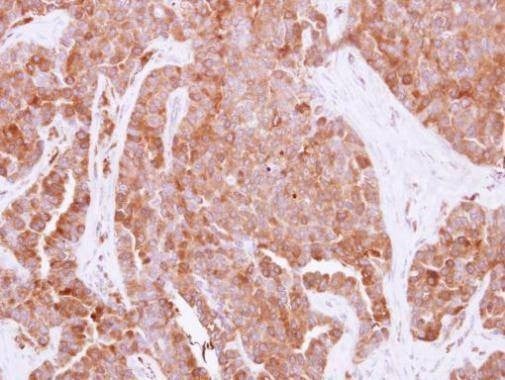Anti-HPRT Antibody
