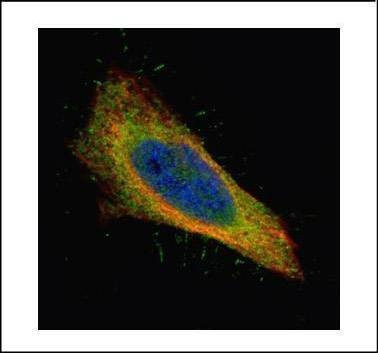 Anti-Filamin B (N-term) Antibody