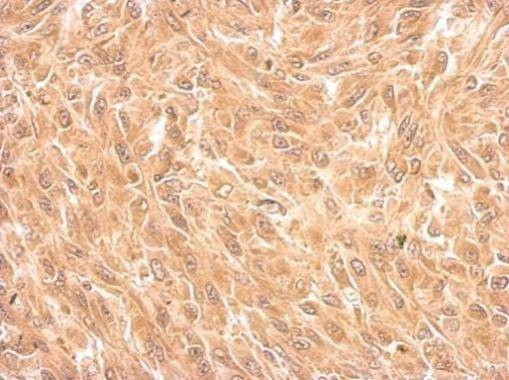 Anti-Filamin B (N-term) Antibody
