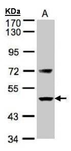 Anti-Factor VII Antibody