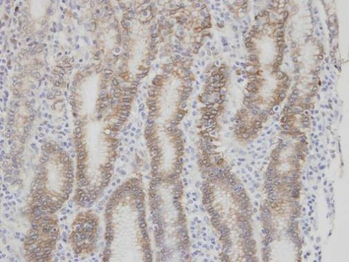 Anti-Factor VII Antibody