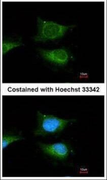 Anti-GBA Antibody