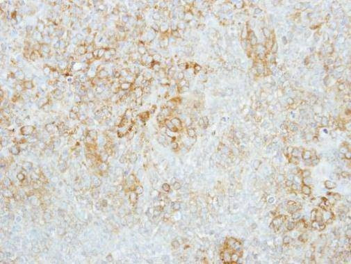Anti-GBA Antibody