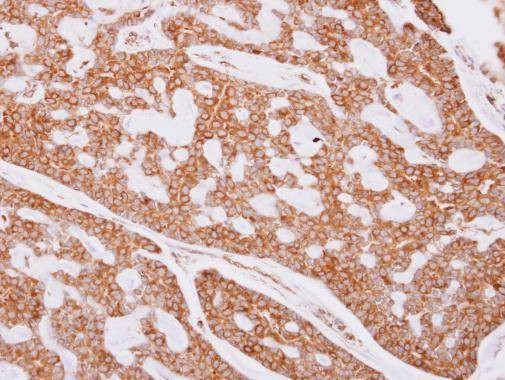Anti-beta Tubulin Antibody