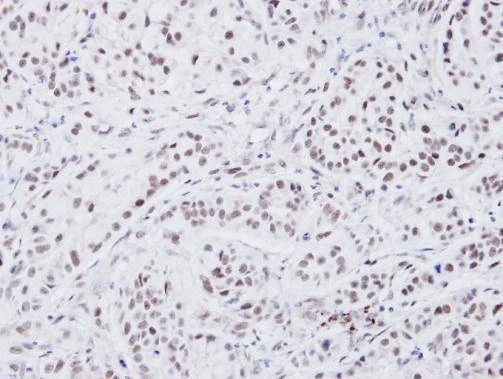 Anti-Rad54 (C-term) Antibody