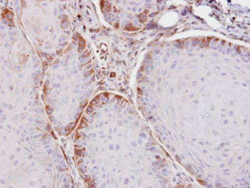 Anti-ASS1 Antibody