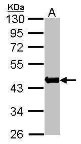 Anti-alpha Actin (skeletal muscle) Antibody