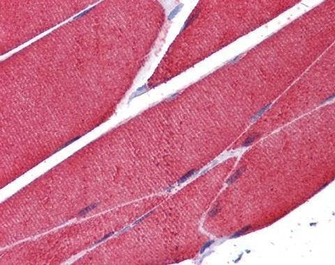 Anti-alpha Actin (skeletal muscle) Antibody