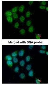 Anti-A-RAF Antibody