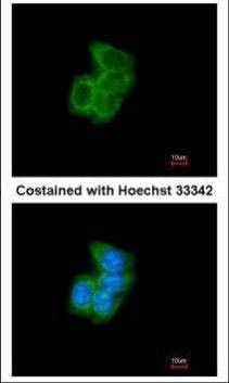 Anti-PDI Antibody