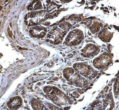 Anti-PDI Antibody