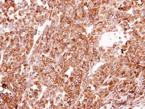 Anti-PDI Antibody
