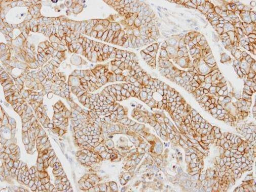 Anti-AP2M1 Antibody