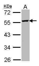 Anti-ODC Antibody