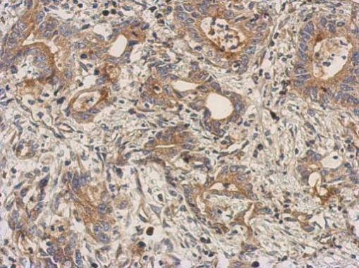 Anti-LEFTY2 Antibody
