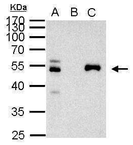 Anti-PAX8 Antibody
