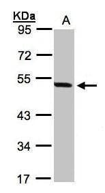 Anti-PAX8 Antibody