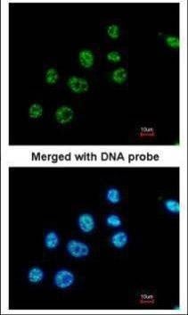 Anti-PAX8 Antibody