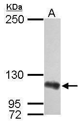 Anti-ADAR1 (internal) Antibody