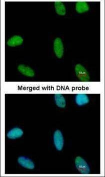Anti-ADAR1 (internal) Antibody