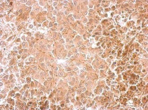 Anti-Dopamine beta hydroxylase Antibody