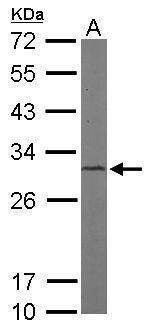 Anti-CAPZB Antibody